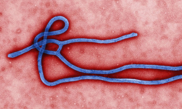 Vírus Nipah pode ser a próxima epidemia, alertam cientístas